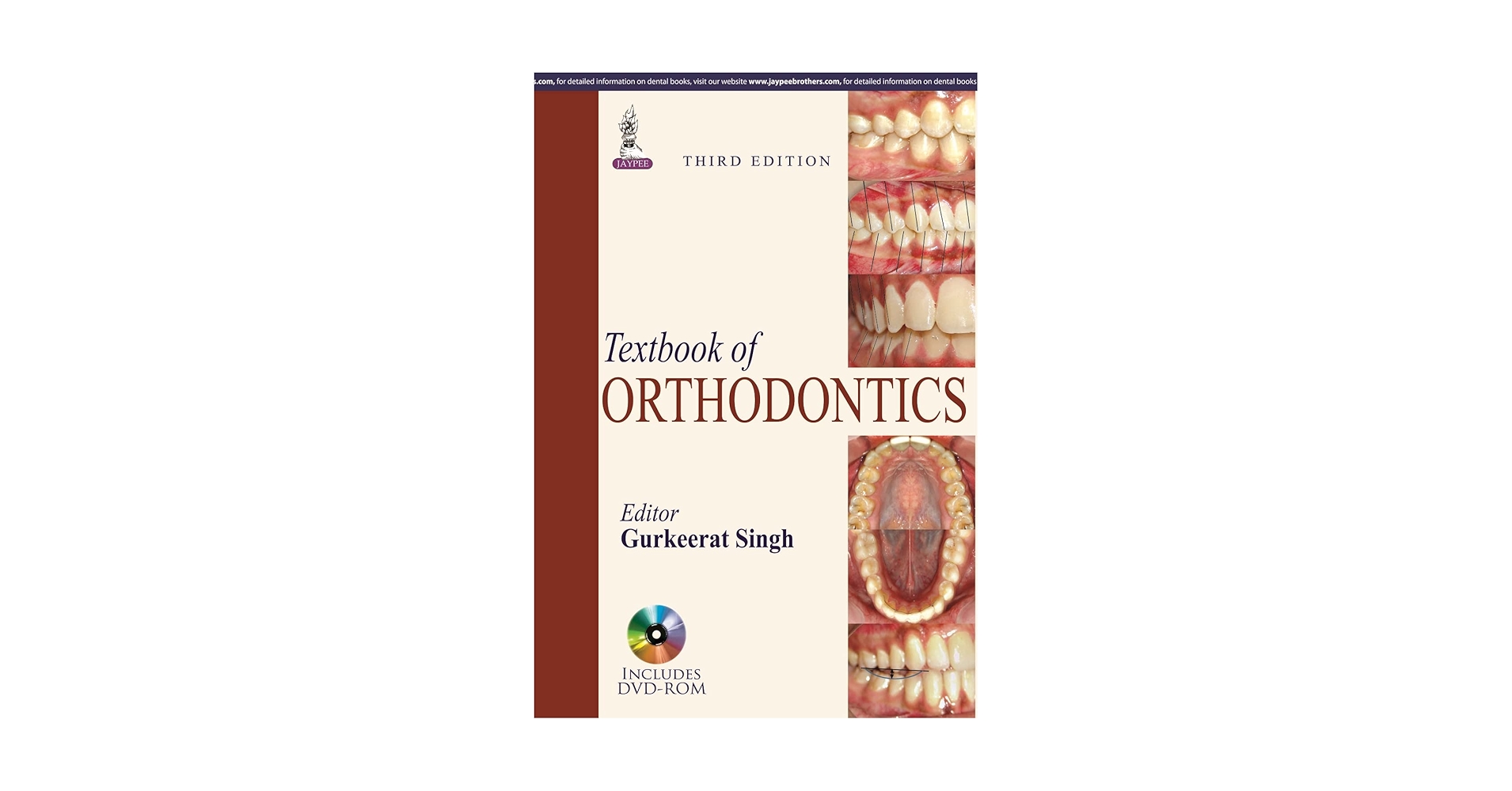 Textbook of Orthodontics: 9789351524403: Medicine & Health